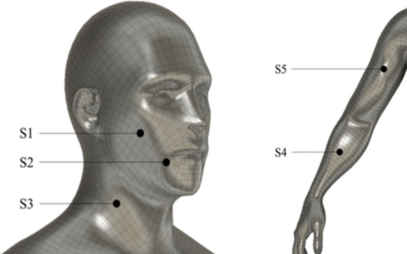Fig. 11.